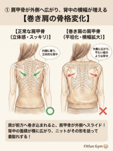 肩甲骨が外側に広がり背中が大きく見える仕組みのイラスト