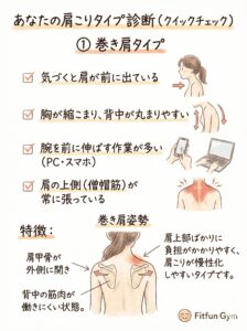 巻き肩タイプの特徴(肩が前へ、背中が丸まる)を示すイラスト