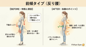 骨盤前傾（反り腰）タイプの特徴と改善ポイントのイラスト